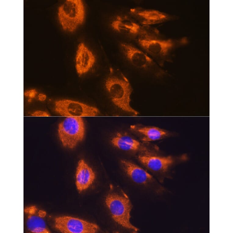 Immunofluorescence - Anti-DAG1 Antibody (A308698) - Antibodies.com