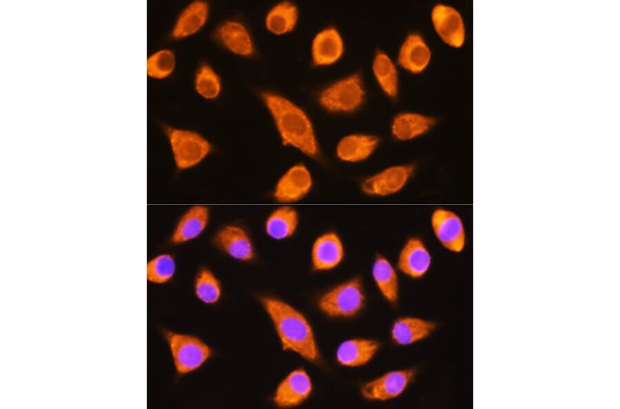 Immunofluorescence - Anti-DAG1 Antibody (A308698) - Antibodies.com