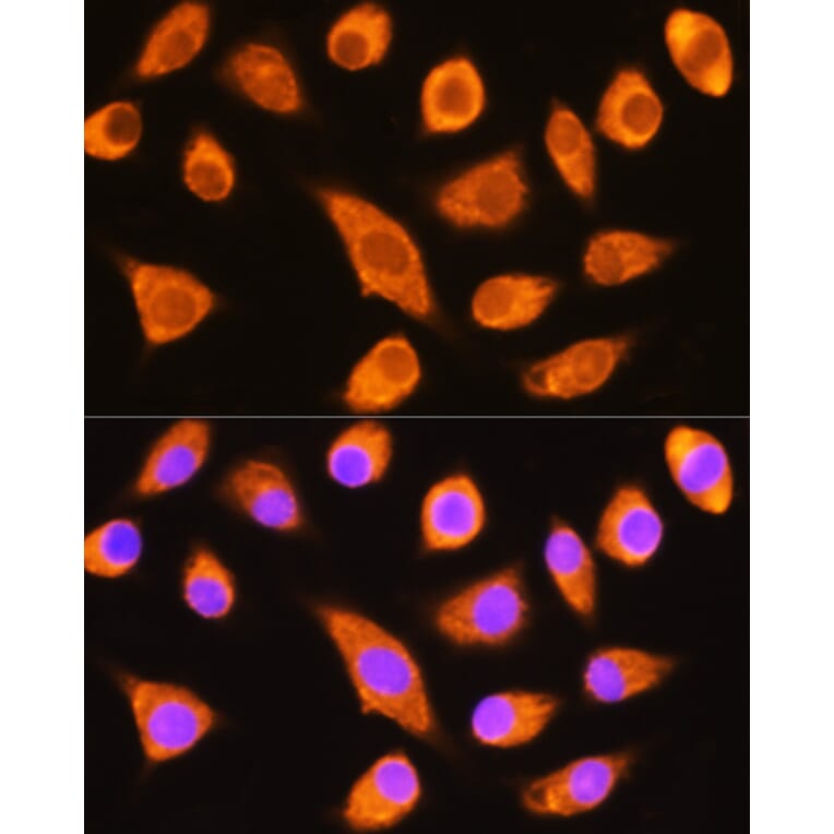 Immunofluorescence - Anti-DAG1 Antibody (A308698) - Antibodies.com