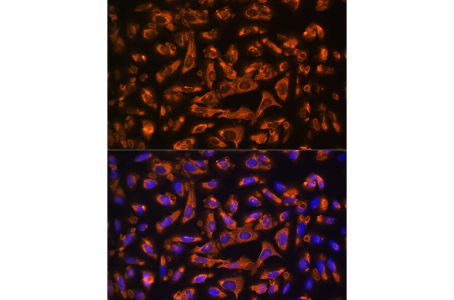 Immunofluorescence - Anti-DAG1 Antibody (A308698) - Antibodies.com