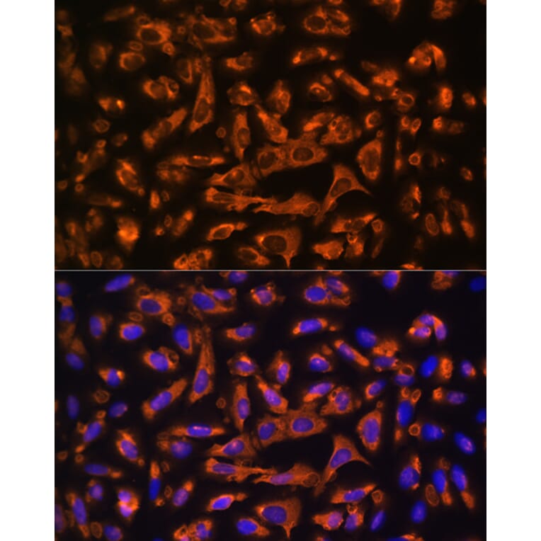 Immunofluorescence - Anti-DAG1 Antibody (A308698) - Antibodies.com
