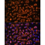 Immunofluorescence - Anti-DAG1 Antibody (A308698) - Antibodies.com