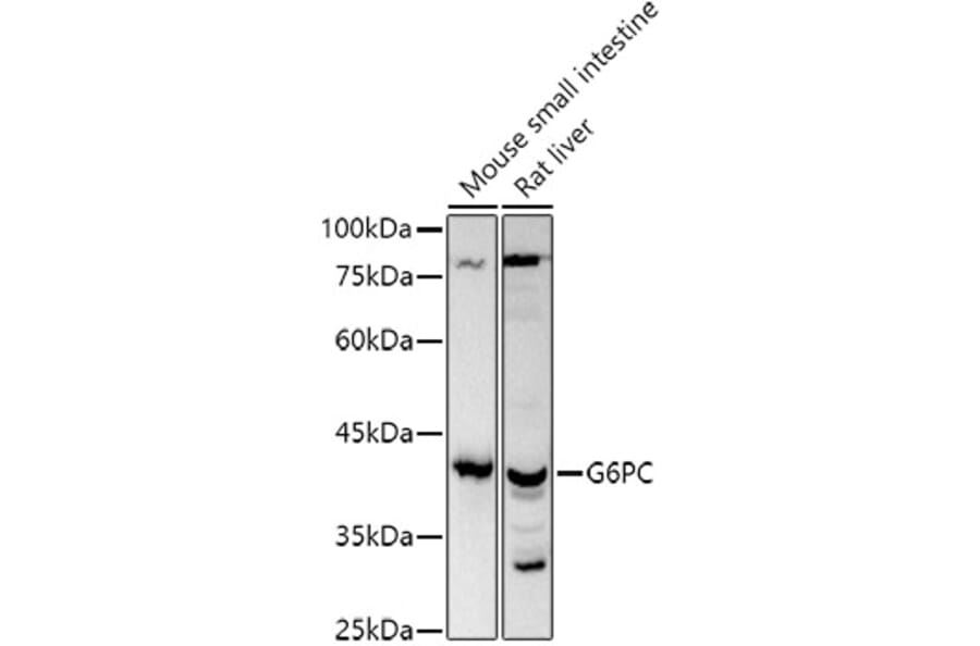 Western Blot - Anti-G-6-Pase Antibody (A308699) - Antibodies.com