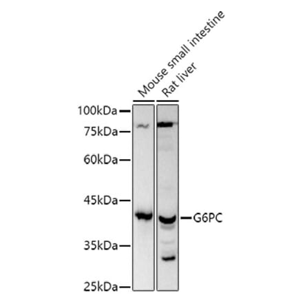 Western Blot - Anti-G-6-Pase Antibody (A308699) - Antibodies.com