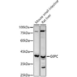 Western Blot - Anti-G-6-Pase Antibody (A308699) - Antibodies.com