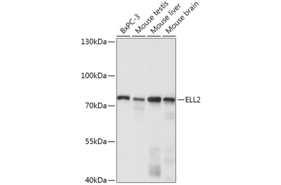 Western Blot - Anti-ELL2 Antibody (A308700) - Antibodies.com