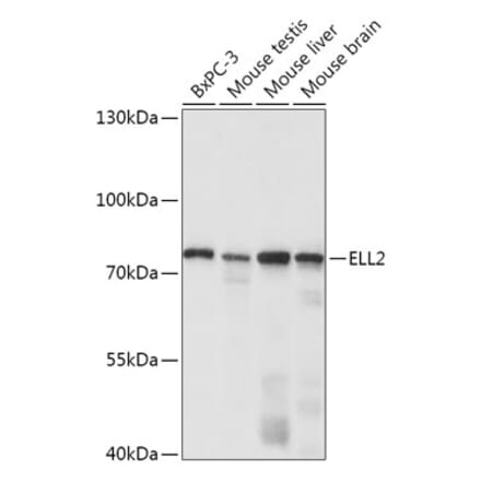Western Blot - Anti-ELL2 Antibody (A308700) - Antibodies.com