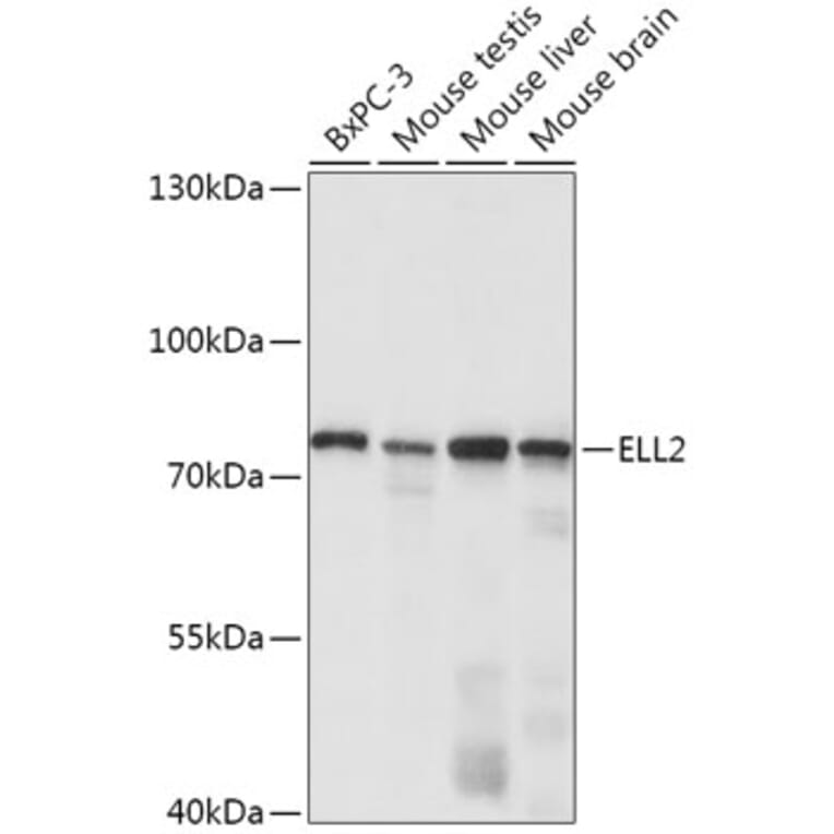 Western Blot - Anti-ELL2 Antibody (A308700) - Antibodies.com