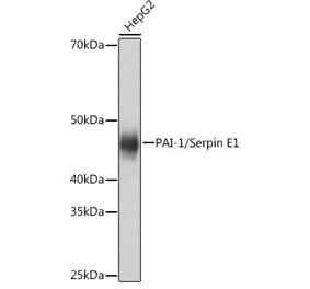 Western Blot - Anti-PAI1 Antibody [ARC0473] (A308701) - Antibodies.com