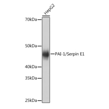 Western Blot - Anti-PAI1 Antibody [ARC0473] (A308701) - Antibodies.com