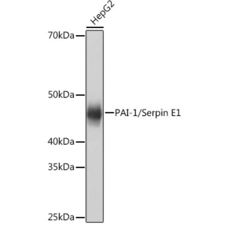 Western Blot - Anti-PAI1 Antibody [ARC0473] (A308701) - Antibodies.com
