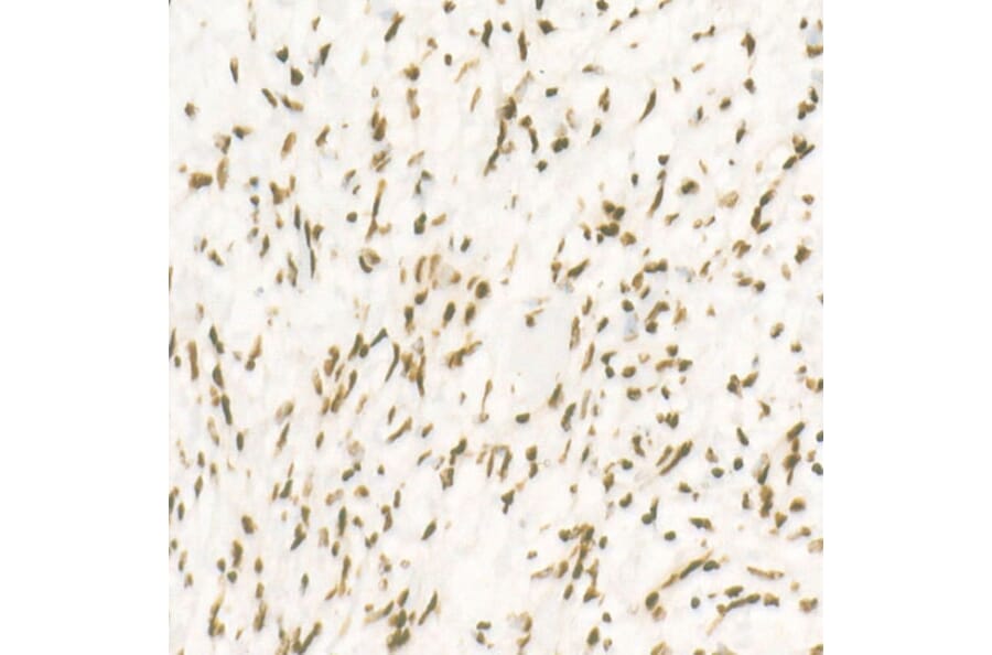 Immunohistochemistry - Anti-CDK12 Antibody [ARC53277] (A308704) - Antibodies.com