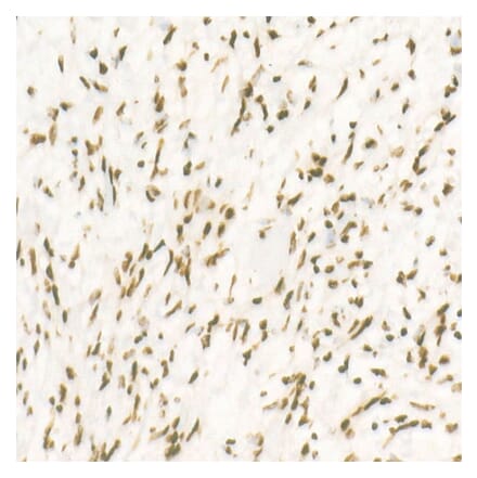 Immunohistochemistry - Anti-CDK12 Antibody [ARC53277] (A308704) - Antibodies.com