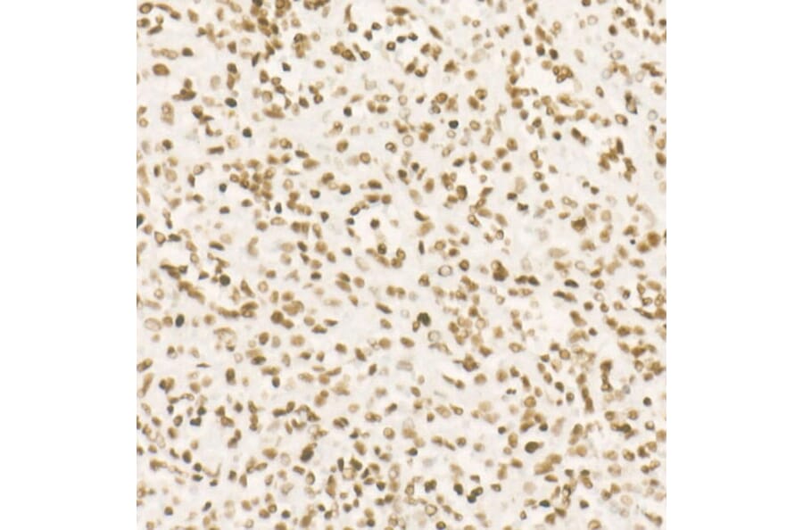 Immunohistochemistry - Anti-CDK12 Antibody [ARC53277] (A308704) - Antibodies.com