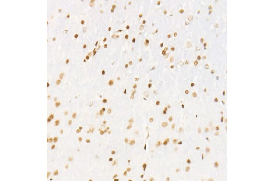 Immunohistochemistry - Anti-CDK12 Antibody [ARC53277] (A308704) - Antibodies.com