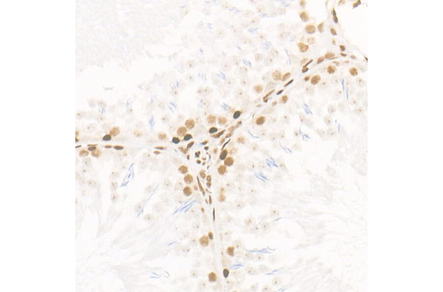 Immunohistochemistry - Anti-CDK12 Antibody [ARC53277] (A308704) - Antibodies.com