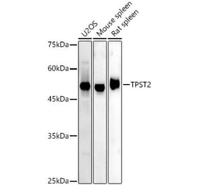 Western Blot - Anti-TPST2 Antibody (A308706) - Antibodies.com