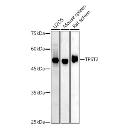 Western Blot - Anti-TPST2 Antibody (A308706) - Antibodies.com