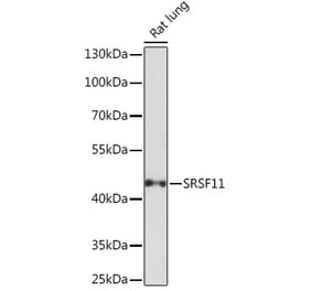 Western Blot - Anti-SFRS11 Antibody (A308707) - Antibodies.com