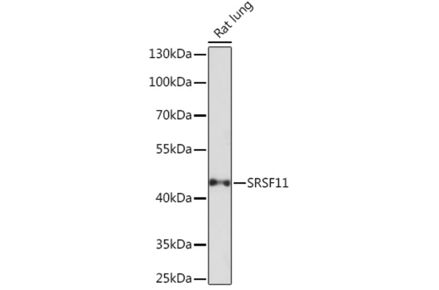Western Blot - Anti-SFRS11 Antibody (A308707) - Antibodies.com