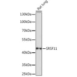 Western Blot - Anti-SFRS11 Antibody (A308707) - Antibodies.com