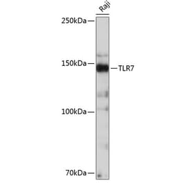 Western Blot - Anti-TLR7 Antibody [ARC0401] (A308708) - Antibodies.com