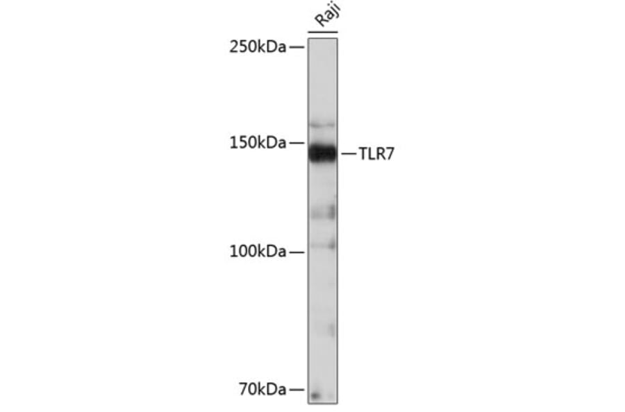 Western Blot - Anti-TLR7 Antibody [ARC0401] (A308708) - Antibodies.com