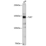 Western Blot - Anti-TLR7 Antibody [ARC0401] (A308708) - Antibodies.com