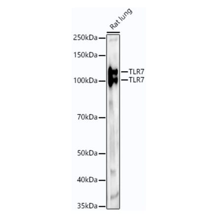 Western Blot - Anti-TLR7 Antibody [ARC53956] (A308709) - Antibodies.com