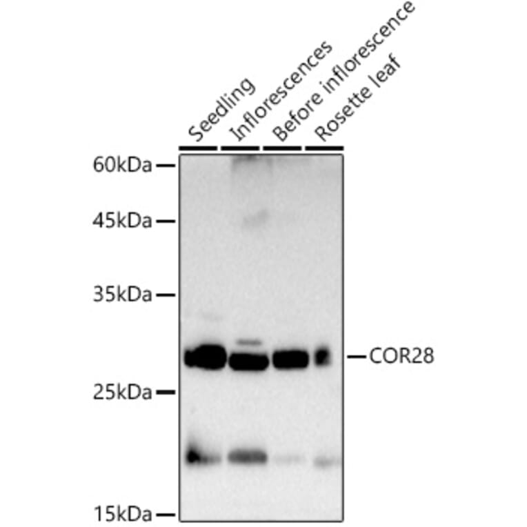 Western Blot - Anti-COR28 Antibody (A308710) - Antibodies.com