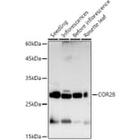 Western Blot - Anti-COR28 Antibody (A308710) - Antibodies.com