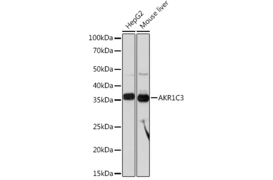 Western Blot - Anti-AKR1C3 Antibody [ARC0857] (A308711) - Antibodies.com