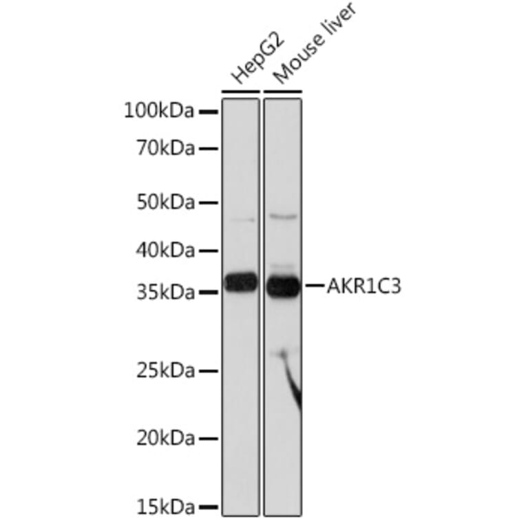 Western Blot - Anti-AKR1C3 Antibody [ARC0857] (A308711) - Antibodies.com