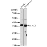 Western Blot - Anti-AKR1C3 Antibody [ARC0857] (A308711) - Antibodies.com