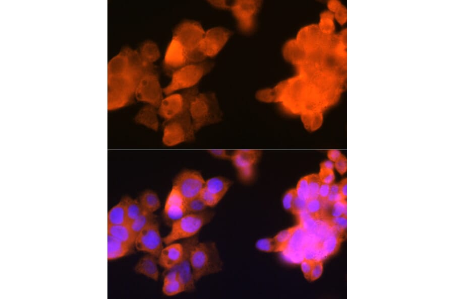 Immunofluorescence - Anti-AKR1C3 Antibody [ARC0857] (A308711) - Antibodies.com