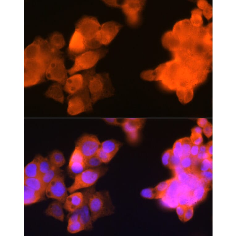 Immunofluorescence - Anti-AKR1C3 Antibody [ARC0857] (A308711) - Antibodies.com