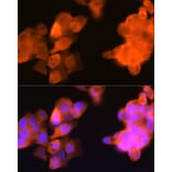 Immunofluorescence - Anti-AKR1C3 Antibody [ARC0857] (A308711) - Antibodies.com