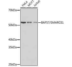 Western Blot - Anti-BAF57/SMARCE1 Antibody [ARC0839] (A308713) - Antibodies.com