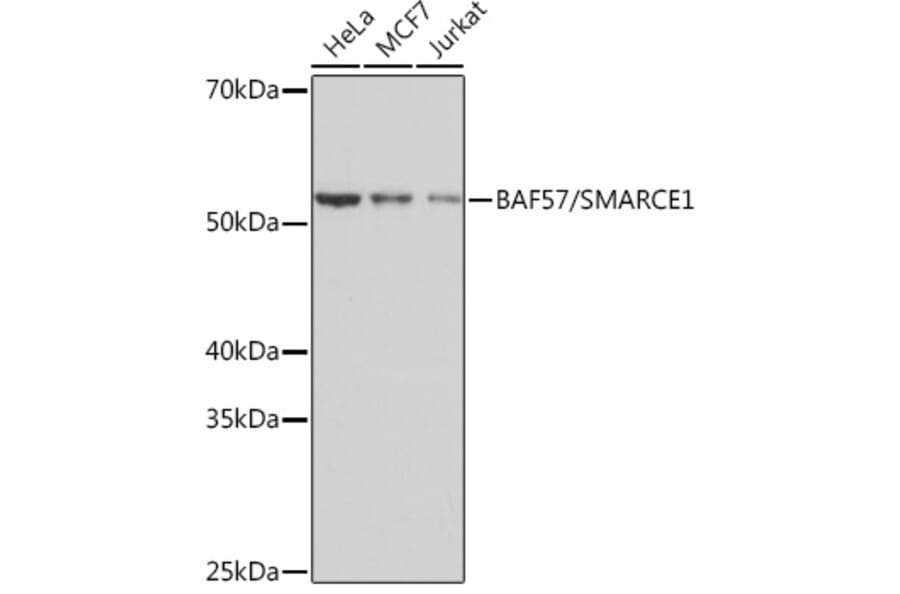 Western Blot - Anti-BAF57/SMARCE1 Antibody [ARC0839] (A308713) - Antibodies.com