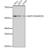 Western Blot - Anti-BAF57/SMARCE1 Antibody [ARC0839] (A308713) - Antibodies.com