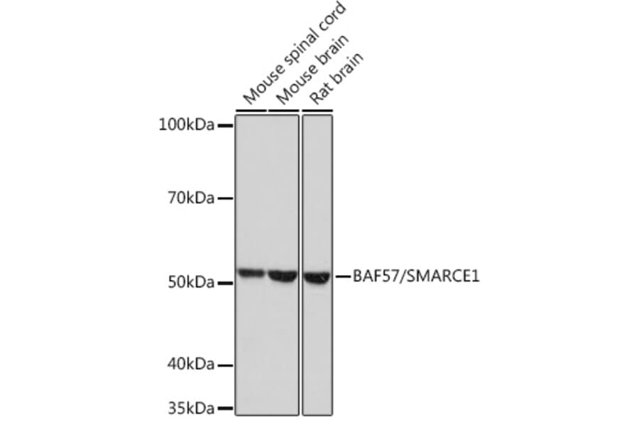 Western Blot - Anti-BAF57/SMARCE1 Antibody [ARC0839] (A308713) - Antibodies.com