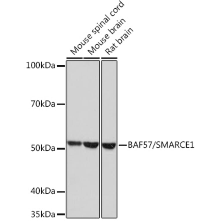 Western Blot - Anti-BAF57/SMARCE1 Antibody [ARC0839] (A308713) - Antibodies.com