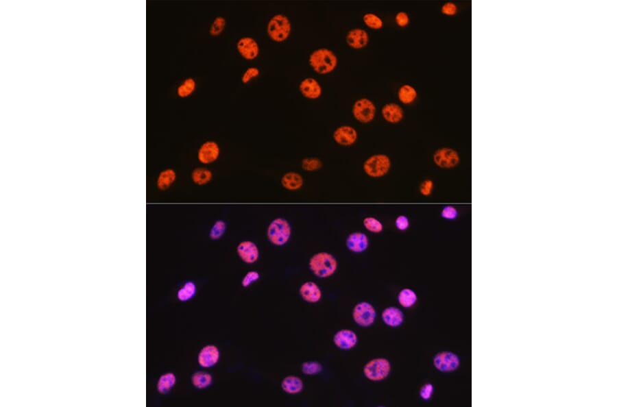 Immunofluorescence - Anti-BAF57/SMARCE1 Antibody [ARC0839] (A308713) - Antibodies.com