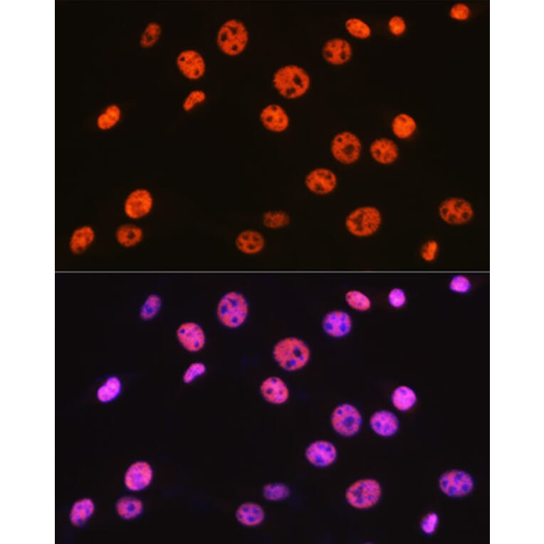 Immunofluorescence - Anti-BAF57/SMARCE1 Antibody [ARC0839] (A308713) - Antibodies.com