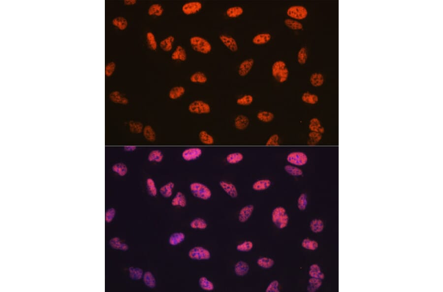 Immunofluorescence - Anti-BAF57/SMARCE1 Antibody [ARC0839] (A308713) - Antibodies.com