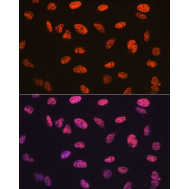 Immunofluorescence - Anti-BAF57/SMARCE1 Antibody [ARC0839] (A308713) - Antibodies.com