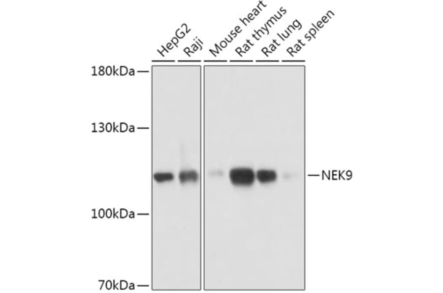 Western Blot - Anti-NEK9 Antibody (A308715) - Antibodies.com