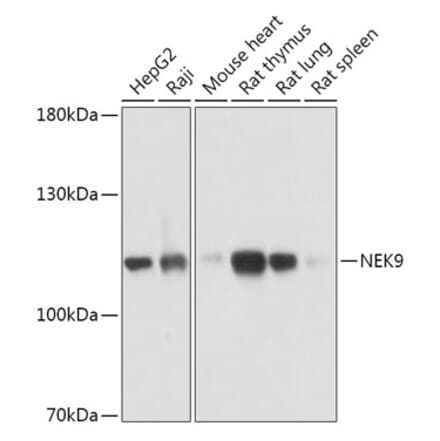 Western Blot - Anti-NEK9 Antibody (A308715) - Antibodies.com