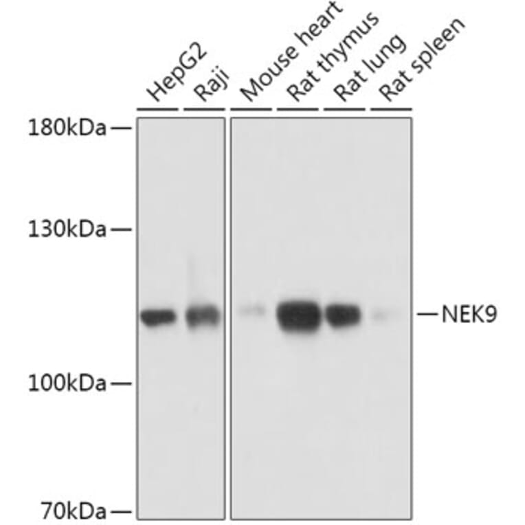 Western Blot - Anti-NEK9 Antibody (A308715) - Antibodies.com