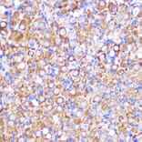 Immunohistochemistry - Anti-NEK9 Antibody (A308715) - Antibodies.com